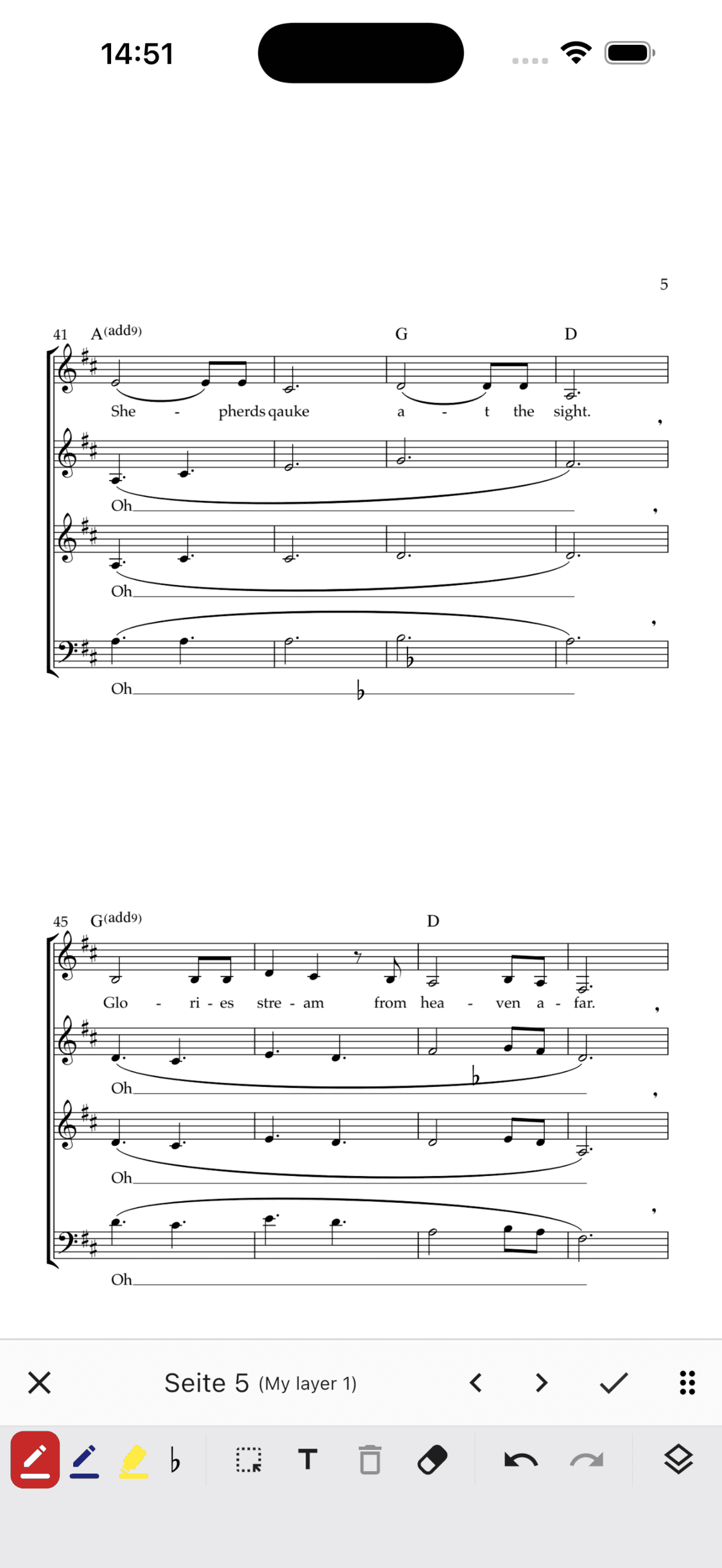 Die Anmerkungsleiste in der ChoirMate-App