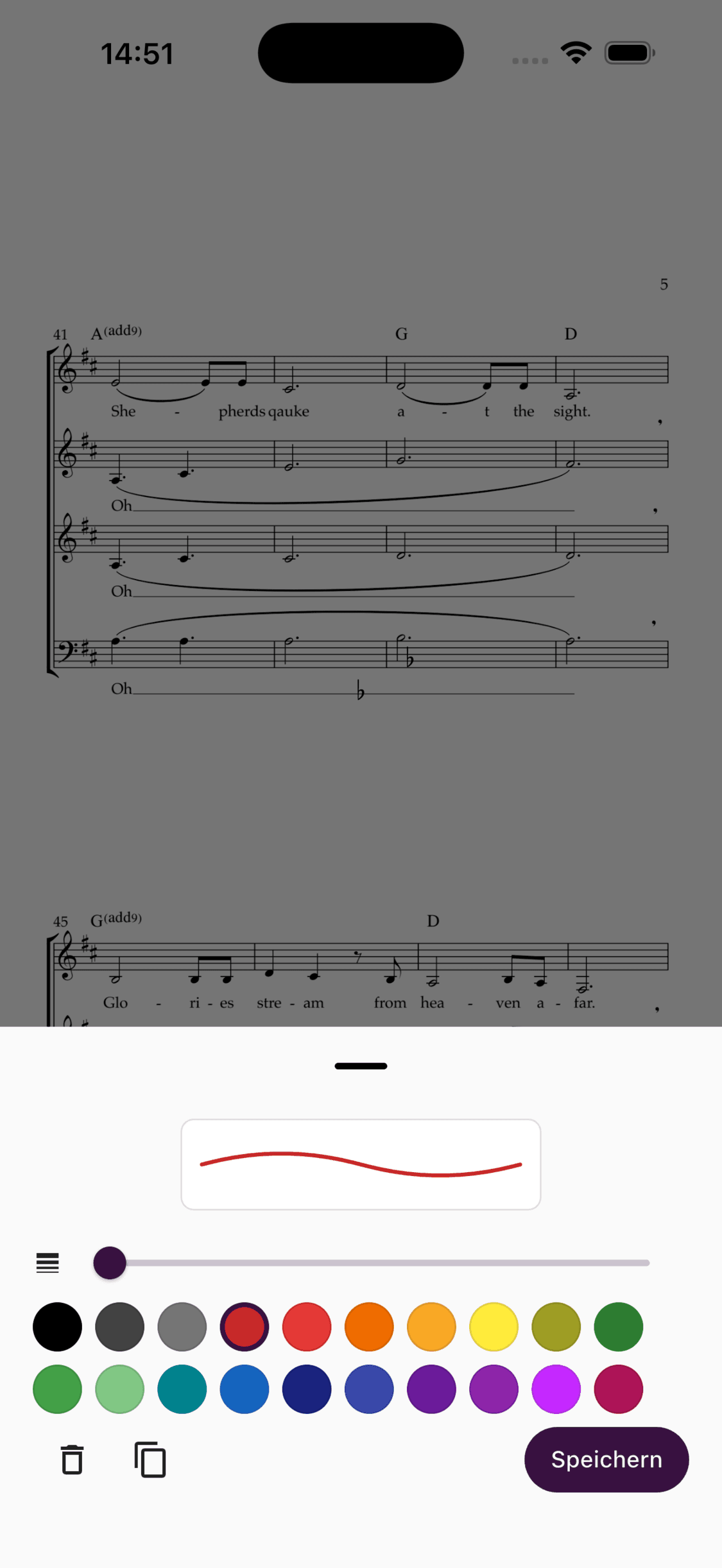 Eine Voreinstellung für Anmerkungen in der ChoirMate-App anpassen