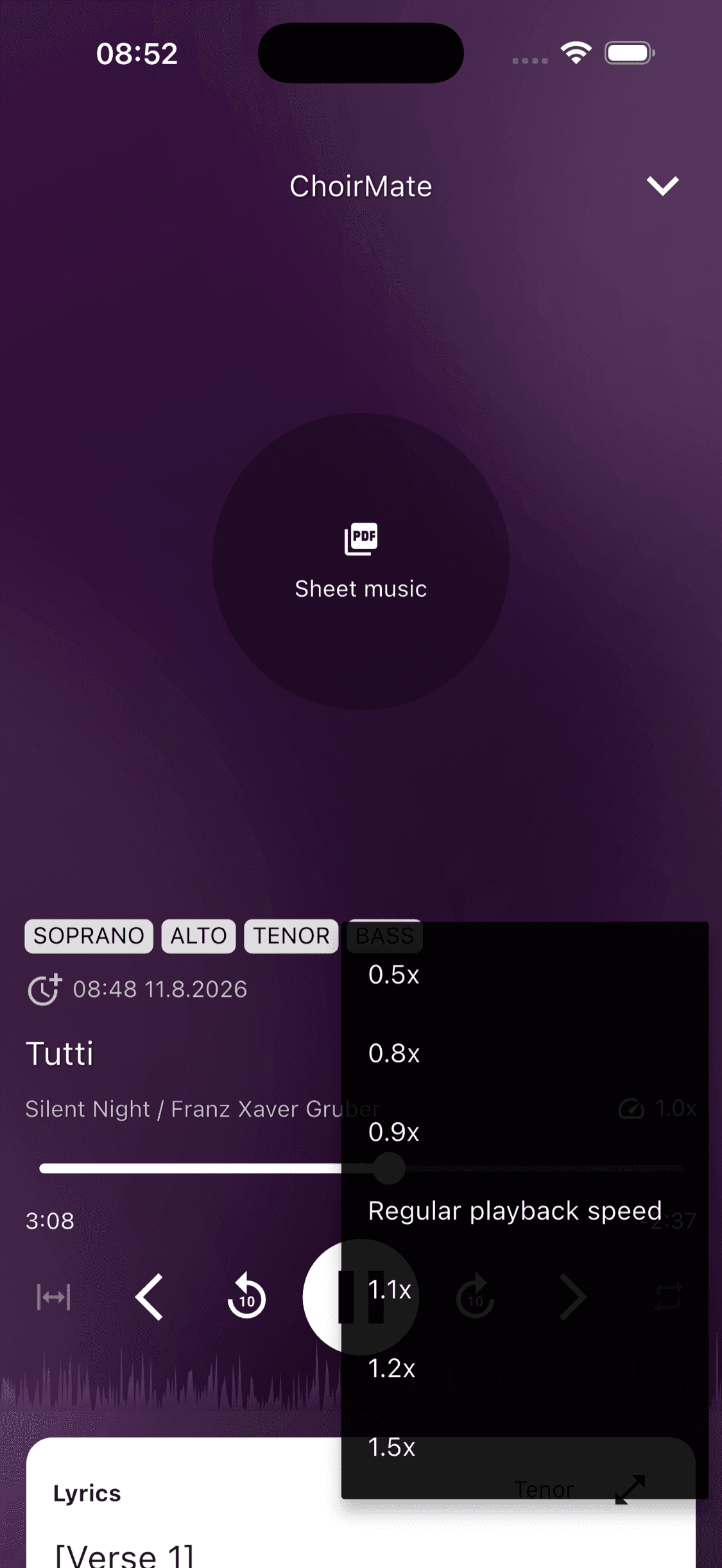 Playback speed choices in the ChoirMate app